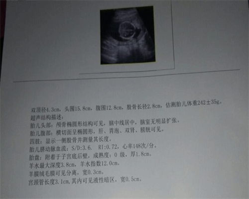 南宁代怀生子之后，广西成都做试管婴儿好的医